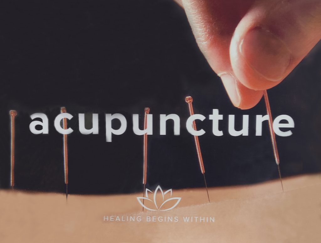 acupuncture chinese medicine